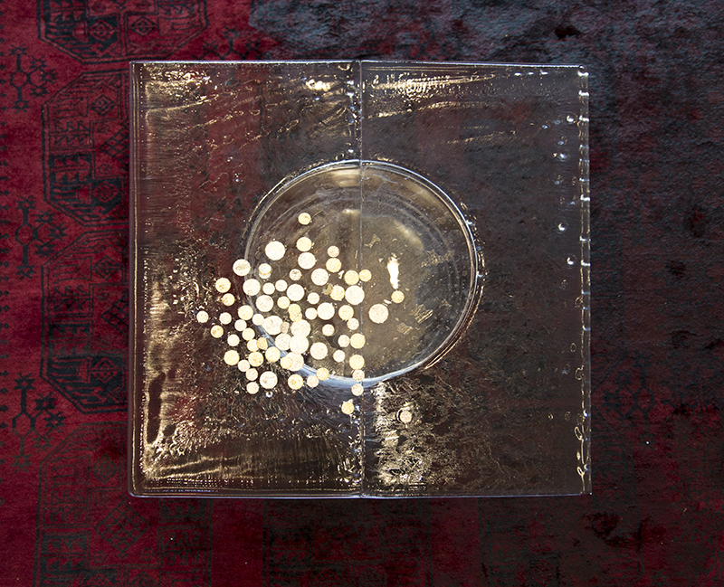 Mary Teague: All my luxuries have turned to misery